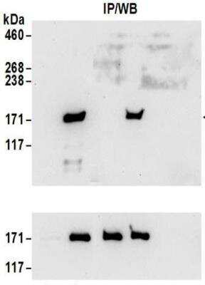 Immunoprecipitation: SMC1 Antibody [NBP2-32142] - Samples:  Whole cell lysate (1 mg for IP; 20% of IP loaded) from 293T cells treated with 100 uM EPE for 2 hours (+) or mock treated (-) cells.  Antibodies: SMC1 was immunoprecipitated using affinity purified rabbit anti-SMC1 antibody NBP2-32142 at 6 ug/mg lysate. Total SMC1 was immunoprecipitated using rabbit anti-SMC1 antibody at 6 ug/mg lysate. SMC1 was blotted at 0.1 ug/ml (upper panel).  Total SMC1 was blotted using at 0.1 ug/ml (lower panel).  Detection: Chemiluminescence with exposure times of 30 seconds.