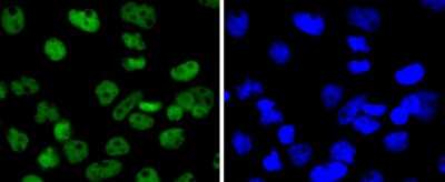 Immunocytochemistry/Immunofluorescence: SMC1 Antibody (SN20-27) [NBP2-67733] - Staining SMC1 in A431 cells (green). The nuclear counter stain is DAPI (blue). Cells were fixed in paraformaldehyde, permeabilised with 0.25% Triton X100/PBS.