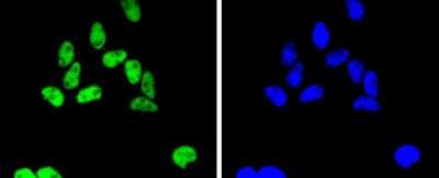 Immunocytochemistry/Immunofluorescence: SMC1 Antibody (SN20-27) [NBP2-67733] - Staining SMC1 in Hela cells (green). The nuclear counter stain is DAPI (blue). Cells were fixed in paraformaldehyde, permeabilised with 0.25% Triton X100/PBS.