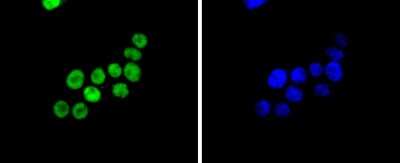 Immunocytochemistry/Immunofluorescence: SMC1 Antibody (SN20-27) [NBP2-67733] - Staining SMC1 in SW480 cells (green). The nuclear counter stain is DAPI (blue). Cells were fixed in paraformaldehyde, permeabilised with 0.25% Triton X100/PBS.