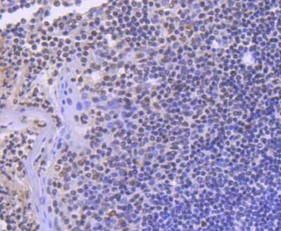 Immunohistochemistry-Paraffin: SMC1 Antibody (SN20-27) [NBP2-67733] - Analysis of paraffin-embedded human tonsil tissue using anti-SMC1 antibody. Counter stained with hematoxylin.