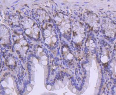Immunohistochemistry-Paraffin: SMC1 Antibody (SN20-27) [NBP2-67733] - Analysis of paraffin-embedded mouse colon tissue using anti-SMC1 antibody. Counter stained with hematoxylin.