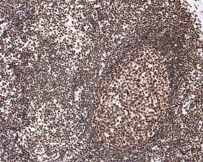 Immunohistochemistry-Paraffin: SMC1 Antibody (SN20-27) [NBP2-67733] - Analysis of paraffin-embedded human lymph nodes tissue with Rabbit anti-SMC1 antibody washed with ddH2O and PBS, and then probed with the primary antibody  at 1/400 dilution for 1 hour at room temperature. The detection was performed using an HRP conjugated compact polymer system. DAB was used as the chromogen. Tissues were counterstained with hematoxylin and mounted with DPX.