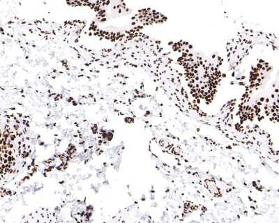 Immunohistochemistry-Paraffin: SMC1 Antibody (SN20-27) [NBP2-67733] - Analysis of paraffin-embedded rat bladder tissue with Rabbit anti-SMC1 antibody washed with ddH2O and PBS, and then probed with the primary antibody  at 1/100 dilution for 1 hour at room temperature. The detection was performed using an HRP conjugated compact polymer system. DAB was used as the chromogen. Tissues were counterstained with hematoxylin and mounted with DPX.