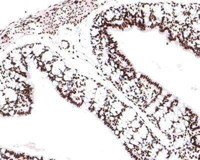 Immunohistochemistry-Paraffin: SMC1 Antibody (SN20-27) [NBP2-67733] - Analysis of paraffin-embedded rat large intestine tissue with Rabbit anti-SMC1 antibody washed with ddH2O and PBS, and then probed with the primary antibody  at 1/400 dilution for 1 hour at room temperature. The detection was performed using an HRP conjugated compact polymer system. DAB was used as the chromogen. Tissues were counterstained with hematoxylin and mounted with DPX.