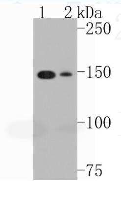 Western Blot: SMC1 Antibody (SN20-27) [NBP2-67733] - Analysis of SMC1 on different lysates. Proteins were transferred to a PVDF membrane and blocked with 5% BSA in PBS for 1 hour at room temperature. The primary antibody (1/500) was used in 5% BSA at room temperature for 2 hours. Goat Anti-Rabbit IgG - HRP Secondary Antibody at 1:5,000 dilution was used for 1 hour at room temperature. Positive control: Lane 1: 293T cell lysate Lane 2: Hela cell lysate