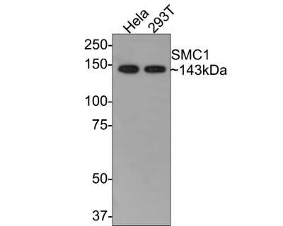 Western Blot: SMC1 Antibody (SN20-27) [NBP2-67733] - Analysis of SMC1 on different lysates with Rabbit anti-SMC1 antibody at 1/500 dilution.Lane 1: Hela cell lysateLane 2: 293T cell lysateLysates/proteins at 10 ug/Lane.Predicted band size: 143 kDaObserved band size: 143 kDaExposure time: 30 seconds;8% SDS-PAGE gel.Proteins were transferred to a PVDF membrane and blocked with 5% NFDM/TBST for 1 hour at room temperature. The primary antibody at 1/500 dilution was used in 5% NFDM/TBST at room temperature for 2 hours. Goat Anti-Rabbit IgG - HRP Secondary Antibody at 1:300,000 dilution was used for 1 hour at room temperature.