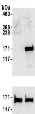 Western Blot: SMC1 Antibody [NBP2-32142] - Samples:  Whole cell lysate (50 ug) from 293T cells treated with 100 uM EPE for 2 hours (+) or mock treated (-).  Antibodies:  Affinity purified rabbit anti-SMC1 antibody NBP2-32142 used for WB at 0.1 ug/ml.   Detection: Chemiluminescence with an exposure time of 30 seconds.  Lower panel shows Westen Blot for total SMC1 using affinity purified rabbit anti-SMC1 antibody at 0.1 ug/ml with an exposure time of 30 seconds.