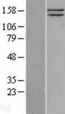 Western Blot: SMC1 Overexpression Lysate (Adult Normal) [NBL1-16236] Left-Empty vector transfected control cell lysate (HEK293 cell lysate); Right -Over-expression Lysate for SMC1.