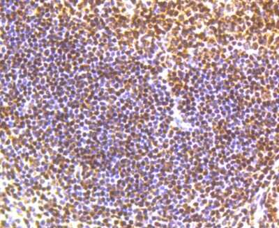 Immunohistochemistry-Paraffin: SMC1 [p Ser957] Antibody (SC65-03) [NBP2-67598] - Analysis of paraffin-embedded human tonsil tissue using anti- phospho -SMC1(S957) antibody. Counter stained with hematoxylin.