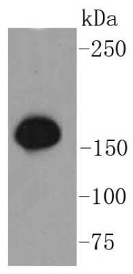 Western Blot: SMC1 [p Ser957] Antibody (SC65-03) [NBP2-67598] - Analysis of SMC1(phospho S957) on Hela cells lysates using anti- phospho -SMC1(S957) antibody at 1/1,000 dilution.
