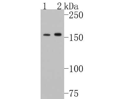 Western Blot: SMC1 [p Ser957] Antibody (SC65-03) [NBP2-67598] - Western blot analysis of SMC1(phospho S957) on Hela cells lysates using anti- phospho -SMC1(S957) antibody at 1/1,000 dilution.