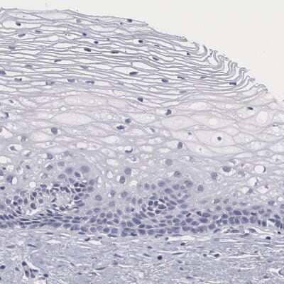 Immunohistochemistry-Paraffin: SMC1L2 Antibody [NBP1-89966] - Staining of human cervix, uterine shows no positivity in squamous epithelial cells as expected.