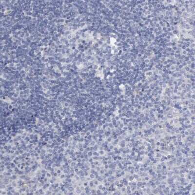 Immunohistochemistry-Paraffin: SMC1L2 Antibody [NBP1-89966] - Staining of human tonsil shows no positivity in lymphoid cells.