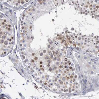 Immunohistochemistry-Paraffin: SMC1L2 Antibody [NBP1-89966] - Staining of human testis shows moderate to strong nuclear positivity in cells in seminiferous ducts.