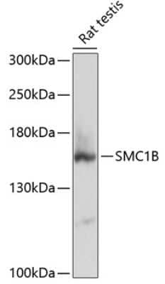 Western Blot: SMC1L2 Antibody [NBP2-94182] - Analysis of extracts of rat testis, using SMC1L2 at 1:3000 dilution.Secondary antibody: HRP Goat Anti-Rabbit IgG (H+L) at 1:10000 dilution.Lysates/proteins: 25ug per lane.Blocking buffer: 3% nonfat dry milk in TBST.Detection: ECL Basic Kit .Exposure time: 30s.