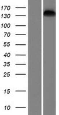 Western Blot: SMC1L2 Overexpression Lysate (Adult Normal) [NBP2-05427] Left-Empty vector transfected control cell lysate (HEK293 cell lysate); Right -Over-expression Lysate for SMC1L2.