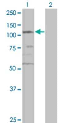 Western Blot: SMC3 Antibody (2F11) [H00009126-M02] - Analysis of SMC3 expression in transfected 293T cell line by CSPG6 monoclonal antibody (M02), clone 2F11.Lane 1: SMC3 transfected lysate(141.5 KDa).Lane 2: Non-transfected lysate.