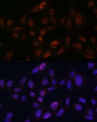 Immunocytochemistry/Immunofluorescence: SMC3 Antibody (8W9R7) [NBP3-15798] - Immunofluorescence analysis of U2OS using SMC3 antibody (NBP3-15798) at dilution of 1:100. Blue: DAPI for nuclear staining.