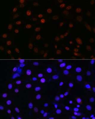 Immunocytochemistry/Immunofluorescence: SMC3 Antibody (8W9R7) [NBP3-15798] - Immunofluorescence analysis of NIH/3T3 using SMC3 antibody (NBP3-15798) at dilution of 1:100. Blue: DAPI for nuclear staining.