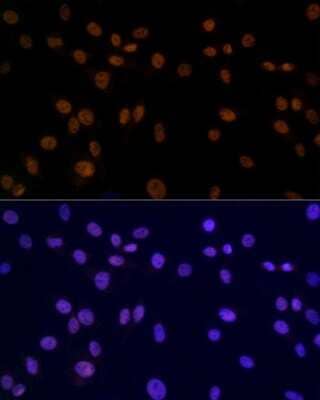 Immunocytochemistry/Immunofluorescence: SMC3 Antibody (8W9R7) [NBP3-15798] - Immunofluorescence analysis of C6 using SMC3 antibody (NBP3-15798) at dilution of 1:100. Blue: DAPI for nuclear staining.