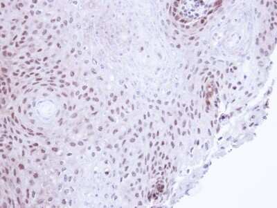 Immunohistochemistry-Paraffin: SMC3 Antibody [NBP2-20418] - Immunohistochemical analysis of paraffin-embedded Cal27 Xenograft, using antibody at 1:100 dilution.