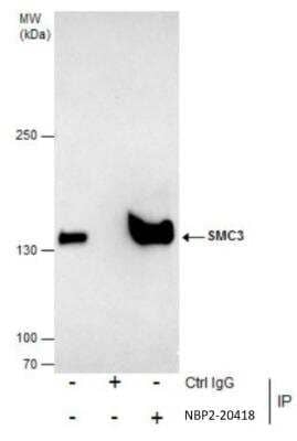 Immunoprecipitation: SMC3 Antibody [NBP2-20418] - Immunoprecipitation of SMC3 protein from HeLa whole cell extracts using 5 ug of SMC3 antibody. Western blot analysis was performed using SMC3 antibody diluted at 1:500.