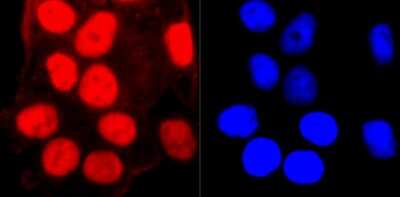 Immunocytochemistry/Immunofluorescence: SMC3 Antibody (JM10-75) [NBP2-67153] - Staining SMC3 in Hela cells (red). The nuclear counter stain is DAPI (blue). Cells were fixed in paraformaldehyde, permeabilised with 0.25% Triton X100/PBS.