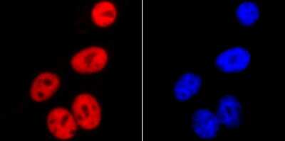 Immunocytochemistry/Immunofluorescence: SMC3 Antibody (JM10-75) [NBP2-67153] - Staining SMC3 in HepG2 cells (red). The nuclear counter stain is DAPI (blue). Cells were fixed in paraformaldehyde, permeabilised with 0.25% Triton X100/PBS.