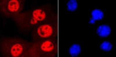 Immunocytochemistry/Immunofluorescence: SMC3 Antibody (JM10-75) [NBP2-67153] - Staining SMC3 in NIH-3T3 cells (red). The nuclear counter stain is DAPI (blue). Cells were fixed in paraformaldehyde, permeabilised with 0.25% Triton X100/PBS.