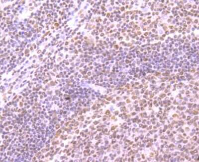 Immunohistochemistry-Paraffin: SMC3 Antibody (JM10-75) [NBP2-67153] - Analysis of paraffin-embedded human tonsil tissue using anti-SMC3 antibody. Counter stained with hematoxylin.