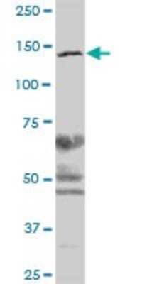 Western Blot: SMC3 Antibody [H00009126-B01P] - Analysis of CSPG6 expression in human colon.