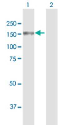 Western Blot: SMC3 Antibody [H00009126-B01P] - Analysis of SMC3 expression in transfected 293T cell line by SMC3 polyclonal antibody.  Lane 1: CSPG6 transfected lysate(133.87 KDa). Lane 2: Non-transfected lysate.