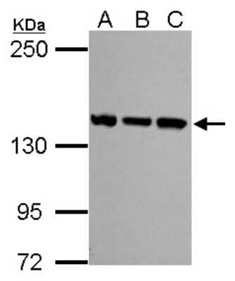 Western Blot: SMC3 Antibody [NBP2-20418] - Sample (30 ug of whole cell lysate) A: NIH-3T3 B: JC C: BCL-1 5% SDS PAGE gel, diluted at 1:1000.