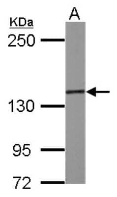 Western Blot: SMC3 Antibody [NBP2-20418] - Sample (30 ug of whole cell lysate) A: PC-12 5% SDS PAGE gel, diluted at 1:2000.