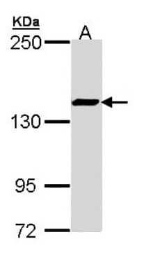 Western Blot: SMC3 Antibody [NBP2-20418] - Sample (30 ug of whole cell lysate) A: Hep G2 5% SDS PAGE gel, diluted at 1:1000.