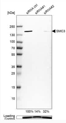 Western Blot: SMC3 Antibody [NBP2-58330] - Analysis in Rh30 cells transfected with control siRNA, target specific siRNA probe #1 and #2, using Anti-SMC3 antibody. Remaining relative intensity is presented. Loading control: Anti-GAPDH.