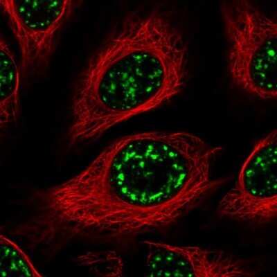 Immunocytochemistry/Immunofluorescence: SMC5 Antibody [NBP2-47271] - Staining of human cell line HeLa shows localization to nuclear speckles. Antibody staining is shown in green.
