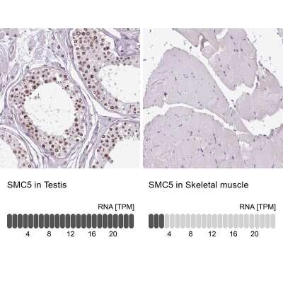 Immunohistochemistry-Paraffin: SMC5 Antibody [NBP2-47271] - Analysis in human testis and skeletal muscle tissues. Corresponding SMC5 RNA-seq data are presented for the same tissues.