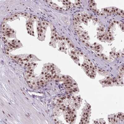 Immunohistochemistry-Paraffin: SMC5 Antibody [NBP2-47271] - Staining of human prostate shows moderate nuclear speckles positivity in glandular cells.
