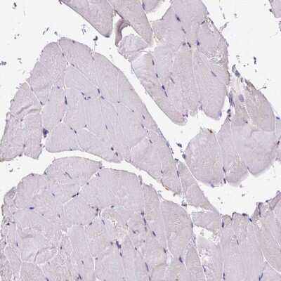 Immunohistochemistry-Paraffin: SMC5 Antibody [NBP2-47271] - Staining of human skeletal muscle shows low positivity in myocytes.