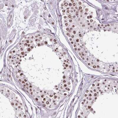 Immunohistochemistry-Paraffin: SMC5 Antibody [NBP2-47271] - Staining of human testis shows moderate nuclear speckles positivity in cells in seminiferous ducts.