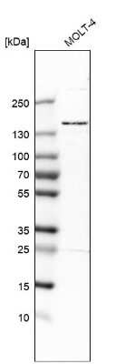 Western Blot: SMC5 Antibody [NBP2-47271] - Analysis in human cell line MOLT-4.
