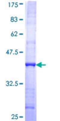 SDS-Page: SMC5 Partial Recombinant Protein [H00023137-Q01]