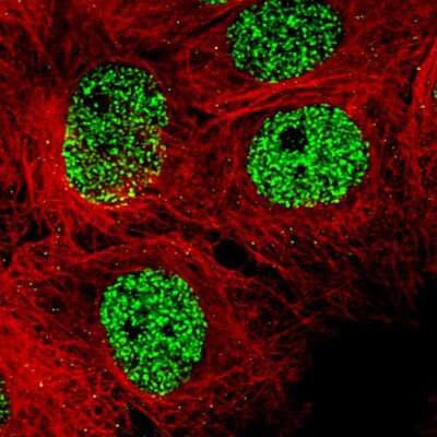 Immunocytochemistry/ Immunofluorescence SMCHD1 Antibody (CL4265) - BSA Free