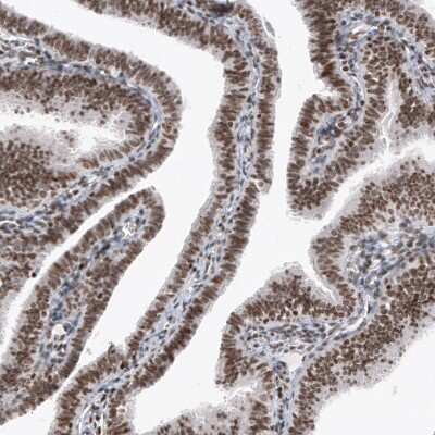 Immunohistochemistry-Paraffin SMCHD1 Antibody (CL4265) - BSA Free