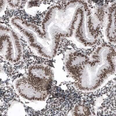Immunohistochemistry-Paraffin SMCHD1 Antibody (CL4265) - BSA Free