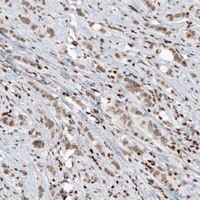 Immunohistochemistry-Paraffin SMCHD1 Antibody (CL4265) - BSA Free
