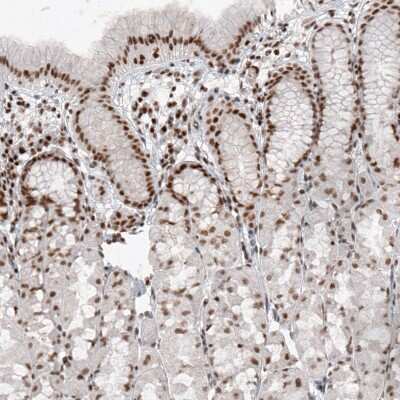 Immunohistochemistry-Paraffin SMCHD1 Antibody (CL4265) - BSA Free