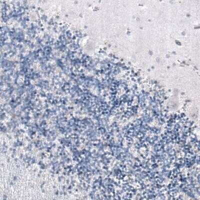 Immunohistochemistry-Paraffin SMCHD1 Antibody (CL4265) - BSA Free